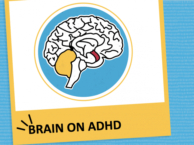 Graphic that says "Brain on ADHD"